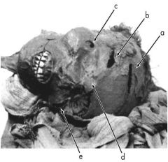 The head of Seqenenre Tao mummy